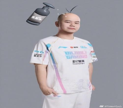 shad0w分享光頭生發(fā)圖：為了我的頭發(fā)我會(huì)繼續(xù)加油的