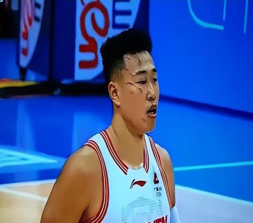 CBA真硬漢！臉部受傷眼都腫了還在場上拼，媒體和球迷：令人敬佩