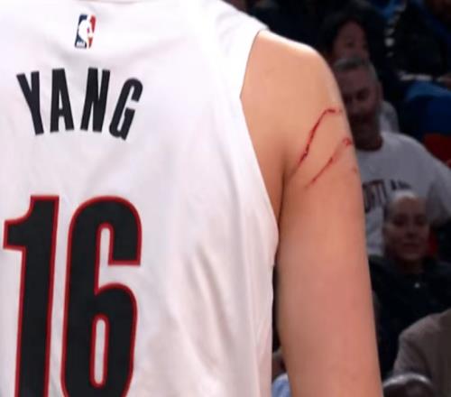 創(chuàng)NBA生涯紀(jì)錄！楊瀚森連7戰(zhàn)登場(chǎng)入輪轉(zhuǎn)被抓出兩道血痕引爭(zhēng)議