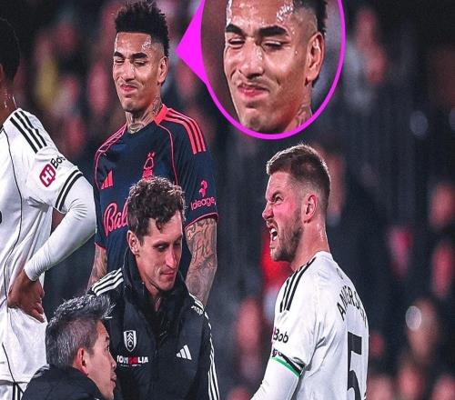 富勒姆后衛(wèi)安諾生比賽中手指脫臼，隊(duì)醫(yī)給他復(fù)位時(shí)他都不敢看