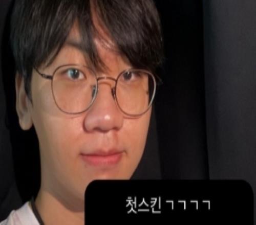 Doran更新動態(tài)：皮膚選擇安蓓薩酒桶卡蜜爾其他