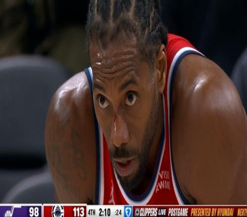 小卡末節20分細節：上籃時(shí)臉被摳出血爵士竟挑戰成功激出戰神卡