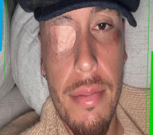 早日康復(fù)，阿根廷前國(guó)腳奧坎波斯左臉面癱，已在接受治療